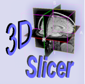 3D Slicer