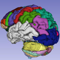 Brain Atlas